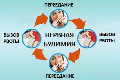 Лечение булимии в Кирово-Чепецке